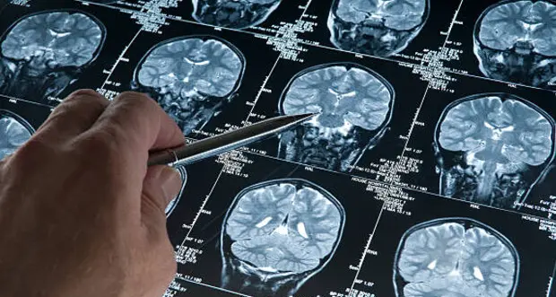 Cambiare stile di vita si può: un passo fondamentale per la prevenzione oncologica