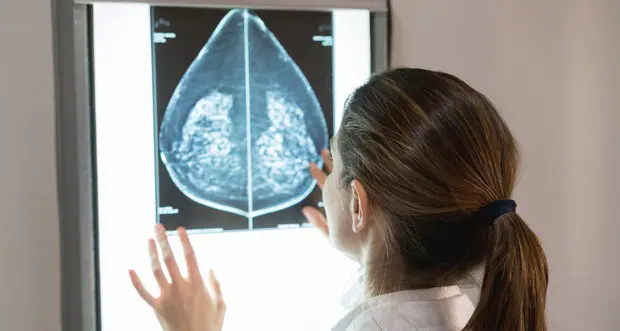 Nel corso del 2024 individuati 255 i tumori al seno