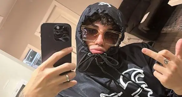 Niky Savage a Trento, appello del sindaco agli organizzatori: «Annullate il concerto»