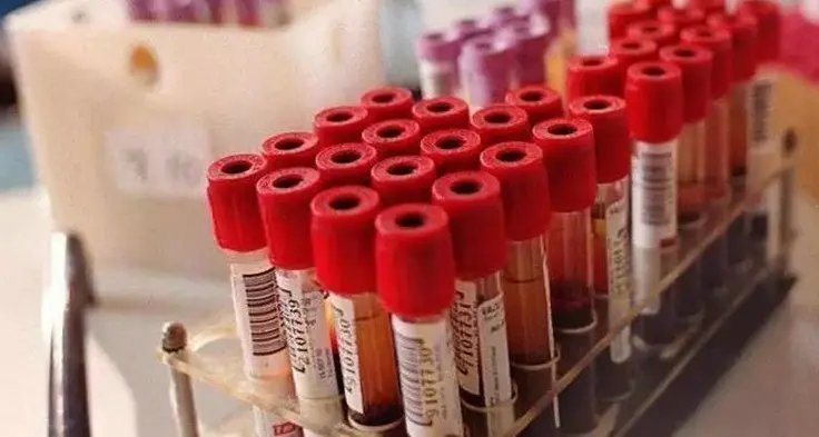 Sostanze inquinanti nell’acqua potabile: al via il monitoraggio su 97 trentini
