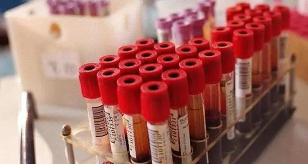 Demenza, diagnosi tempestiva con un semplice test del sangue