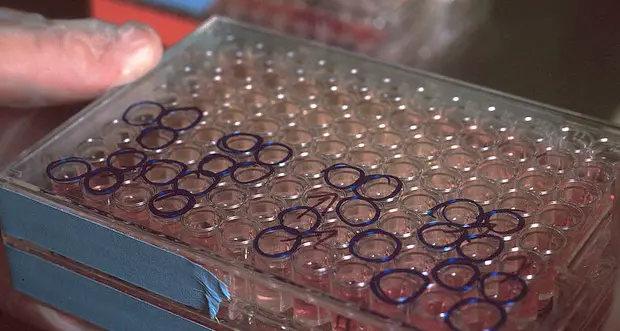 Cura del covid: a marzo l'anticorpo monoclonale di Gsk Vaccines