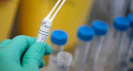 Coronavirus, in arrivo i tamponi rapidi in farmacia Annuncio dell'Apss: riservati a chi ha sintomi