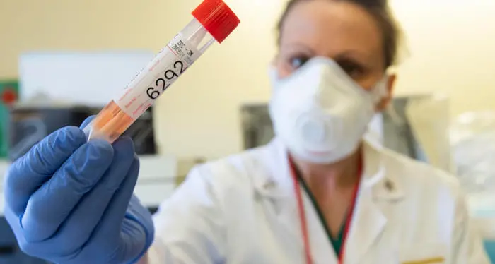 L'allarme Covid dell'Oms: se non si agisce subito rischio 2 milioni di morti