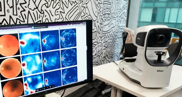 Isolate staminali nel nervo ottico: speranze contro il glaucoma
