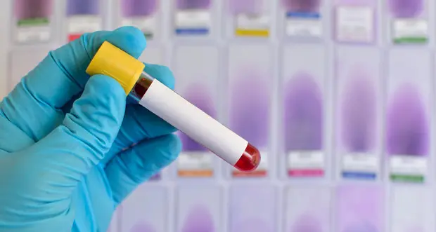 Nuovo test coronavirus, individua tutte le varianti: a disposizione dei laboratori