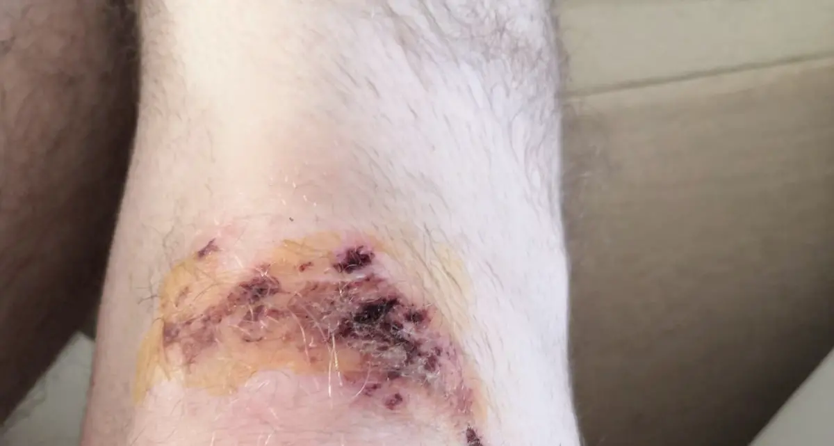 Ragazzo aggredito \"a freddo\" da un giocatore di hockey ora chiede 20mila euro