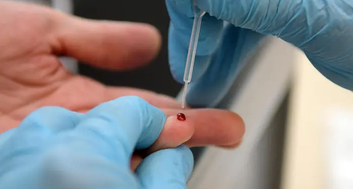 Test sierologici, si userà l'Abbott dal 4 maggio protocollo unico in tutte le Regioni d'Italia