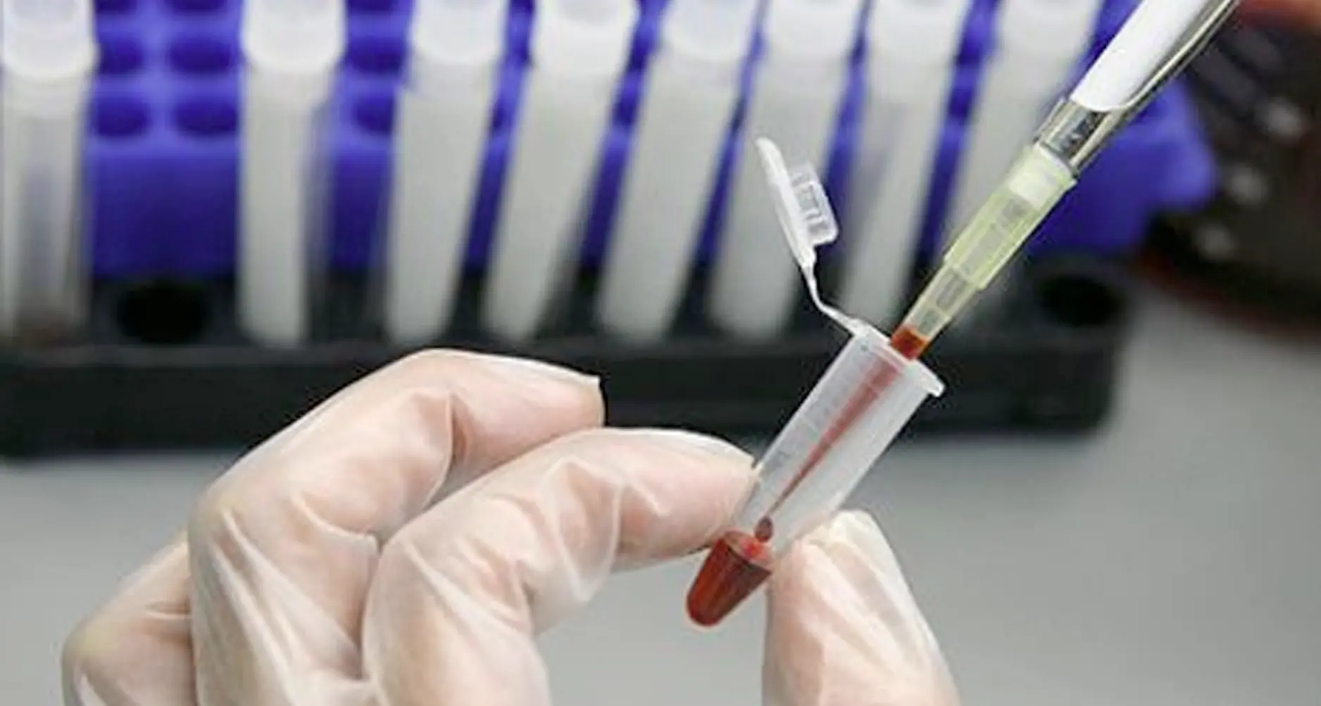 Per fare le analisi del sangue bisogna prenotarsi: vietato accedere ai punti di prelievo