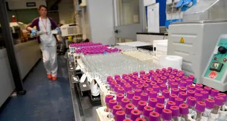 Nuovo caso di tubercolosi In ospedale uno studente dell'Istituto «Veronesi»
