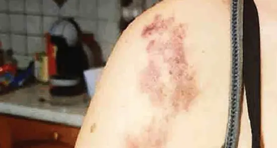 Minacciati con la pistola Parla la ragazza aggredita