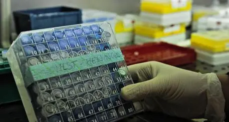 Muore per setticemia fulminante Paura per il batterio killer