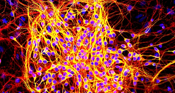 Una mutazione genetica è all'origine della calvizie