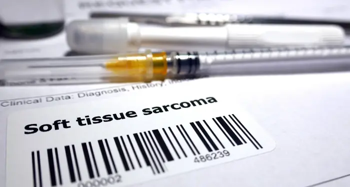 Tecnologia e stampa in 3D nuove speranze per la cura dei sarcomi oncologici
