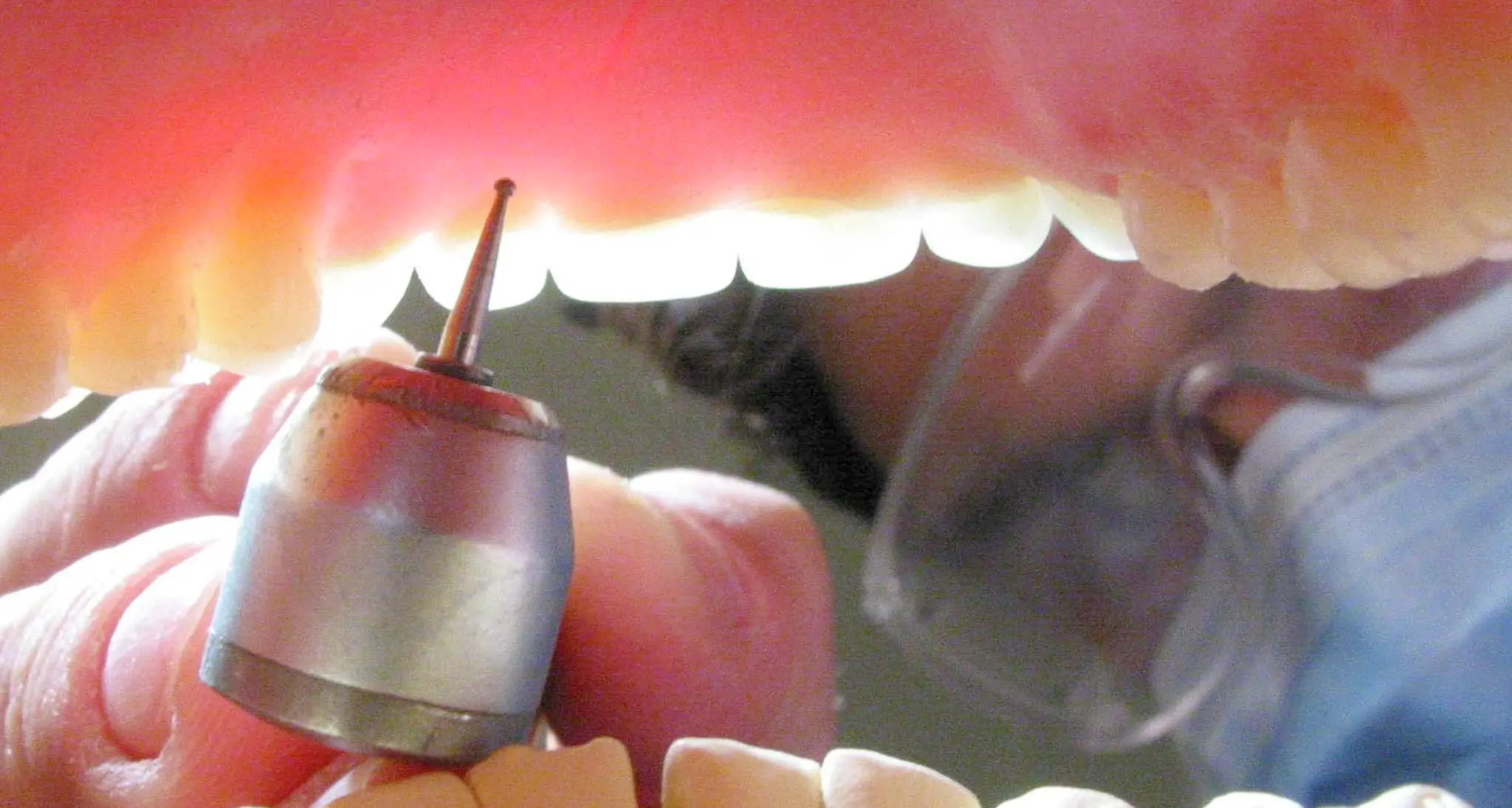 Il dentista può vedere in bocca segni di malattie anche gravi: il 13 e 14 convegno in Trentino