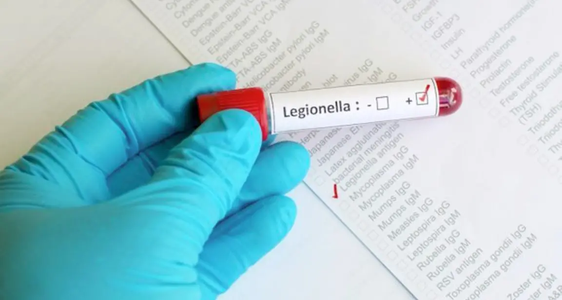 Legionella, Roma ordina controlli dopo i decessi in Paganella