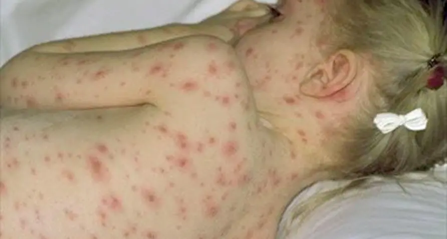 Report: con i vaccini si evitano mille malati In aumento chi lo fa contro l'influenza