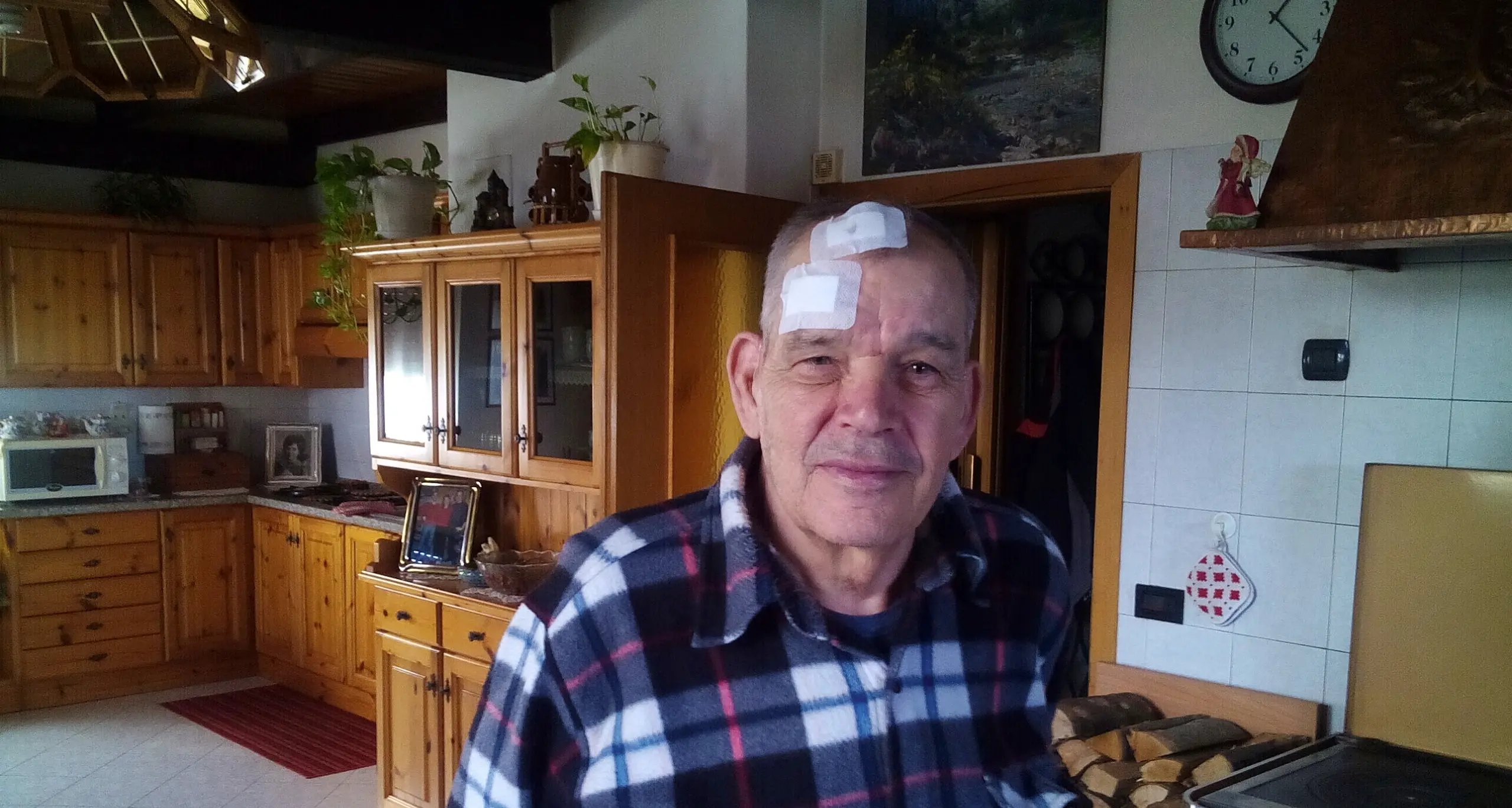 Caldonazzo, il racconto: «Un rapinatore mi ha ferito, allora ho colpito anch'io»