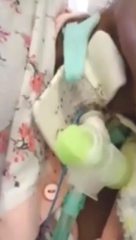 Morta la donna sommersa dalle formiche nell'ospedale a Napoli