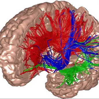 Asimmetrie emisferiche delle connessioni cerebrali