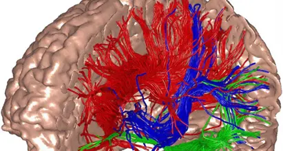 Asimmetrie emisferiche delle connessioni cerebrali