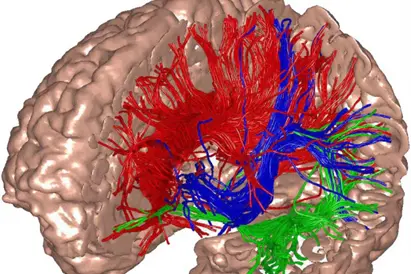 Asimmetrie emisferiche delle connessioni cerebrali