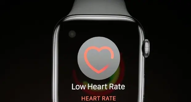 Cardiologi Usa valutano sensore per il cuore Apple Watch