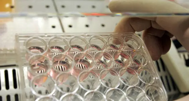 Tumore del seno iniziale, la chemio evitabile nel 70% dei casi