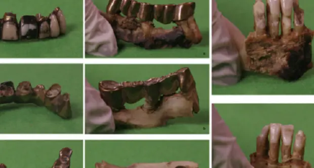 Dai denti di Hitler la prova che era vegetariano