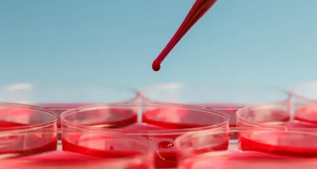 Verso un test del sangue per predire la leucemia anni prima dell'esordio