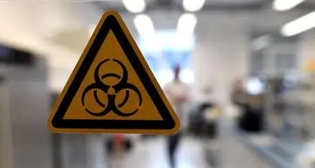 Legionella, salgono a 27 i contagiati nel Milanese