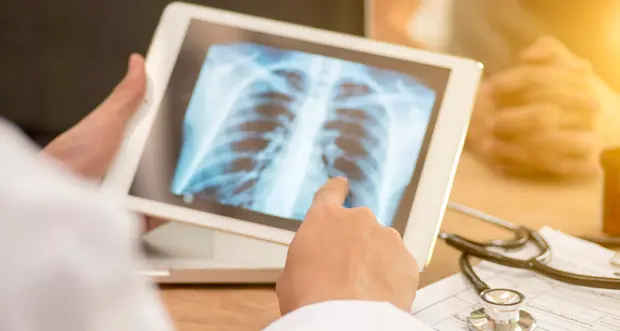 Tubercolosi, 2 milioni i ragazzi colpiti ogni anno nel mondo