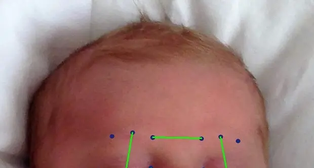Nasce l'app che misura il dolore del neonato