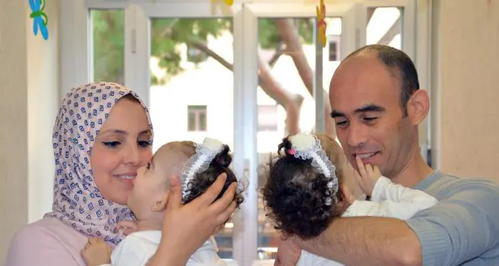 A Roma separate gemelle siamesi algerine, stanno bene