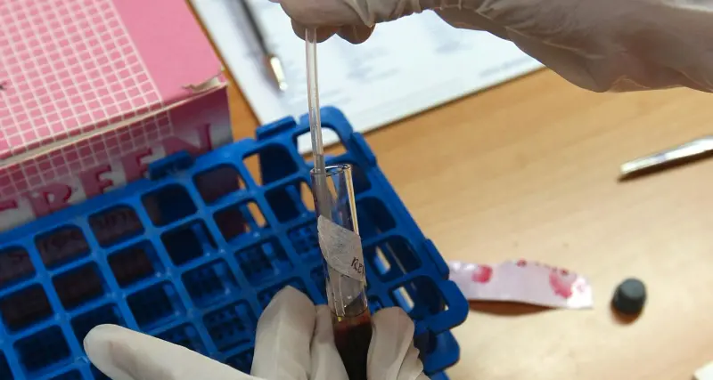 Allarme alto per l'Aids Già 20 casi quest'anno