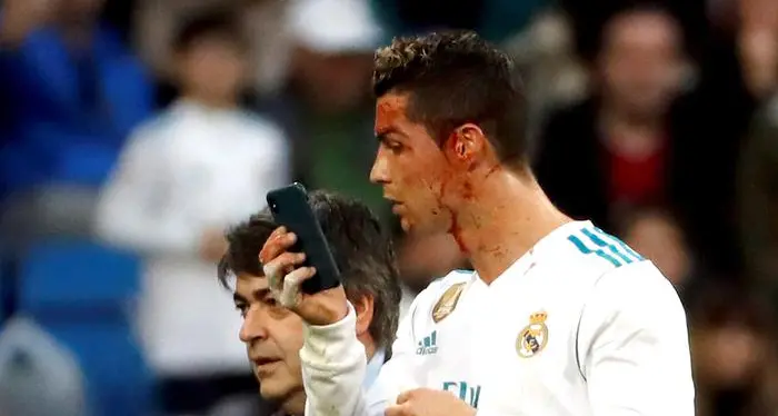 Cristiano Ronaldo: gol, infortunio e telefono per specchiarsi