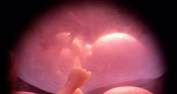 Trasfusioni e trapianto in utero per la prima volta al mondo