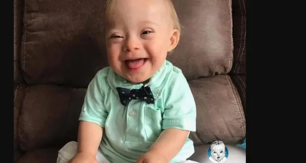 Ha la sindrome di Down il nuovo bambino Gerber