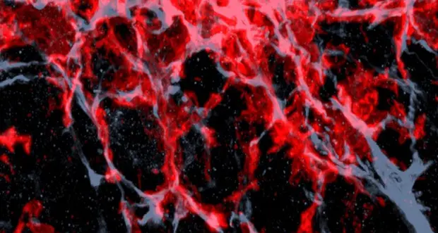 Scoperta la proteina che innesca la crescita dei tumori