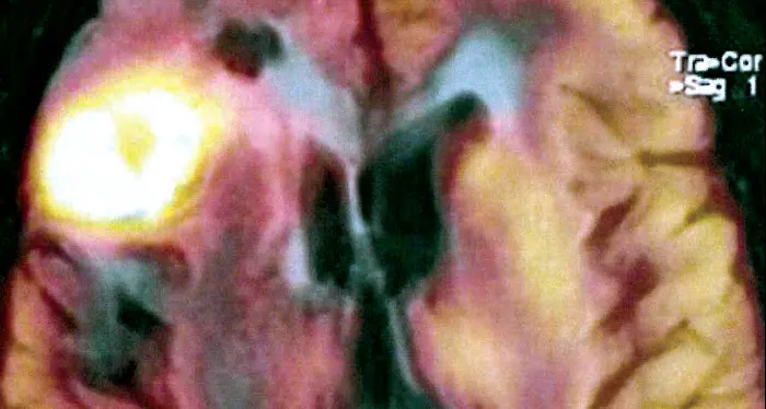 Medicina nucleare