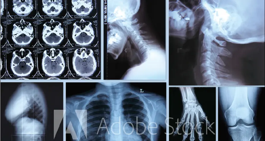 Michele Sessa primario di radiologia per gli ospedali di Borgo e Cavalese