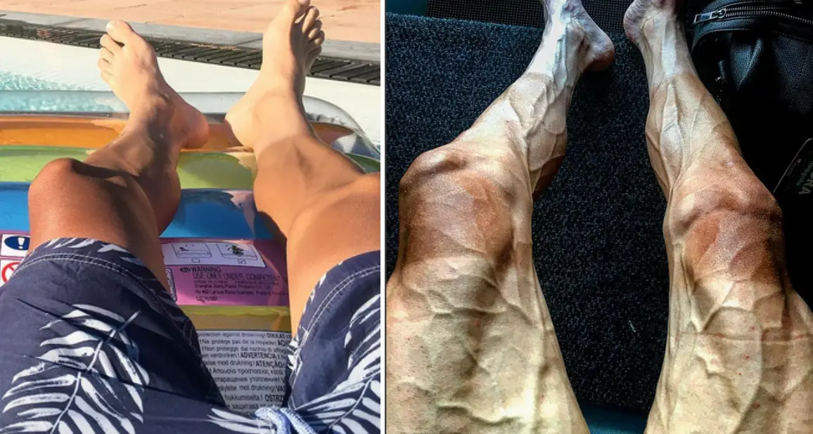 La fatica della bici: le gambe prima e dopo il Tour de France