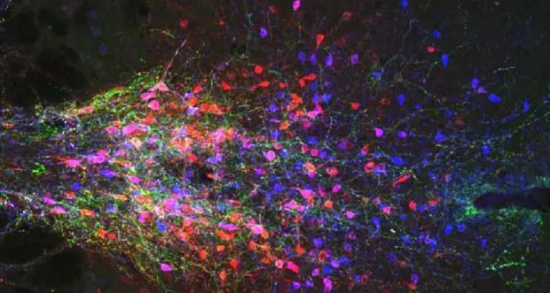 Trovato nel cervello il circuito dell'insonnia