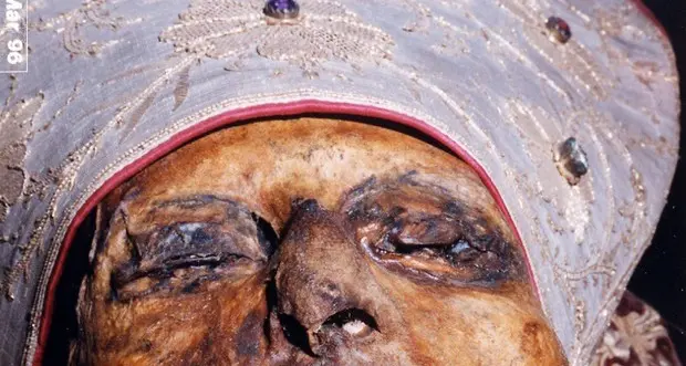 Svelata la malattia che stroncò S. Ubaldo patrono di Gubbio