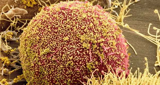 Virus Hiv: scoperto il modo per snidarlo dai nascondigli