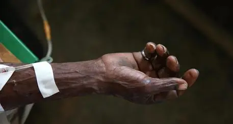 Autobus sulla folla ad Haiti, 34 morti e 15 feriti