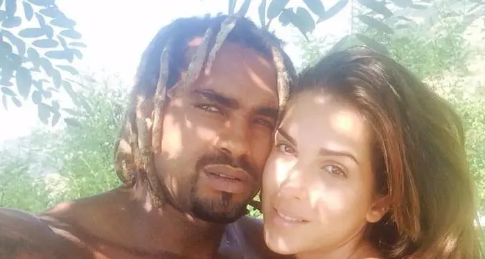 Sfregiata con l'acido dall'ex fidanzato