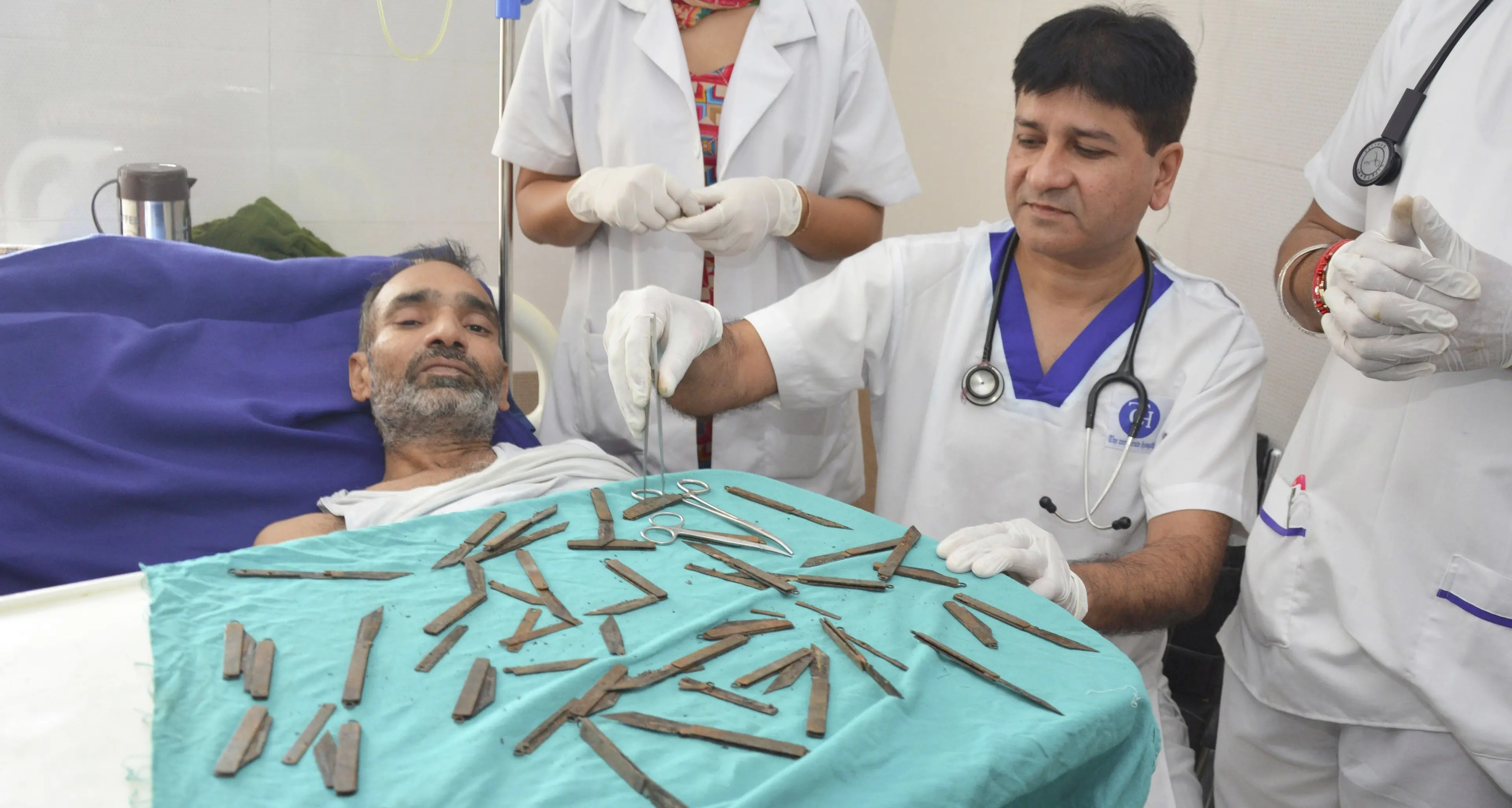 India, ingoia 20 coltelli Operato per ben 5 ore