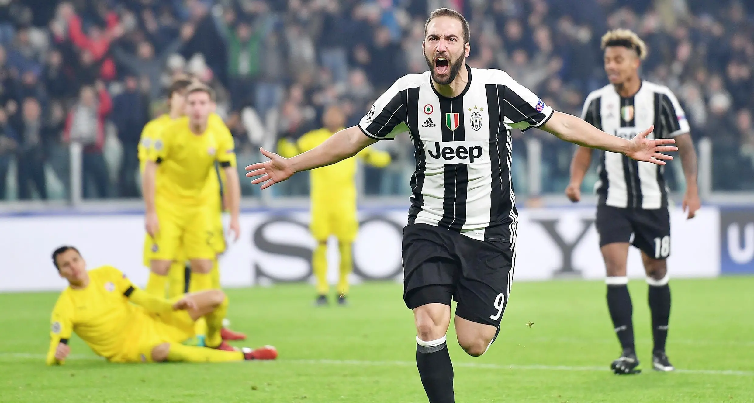 Higuain operato alla mano Salterà il big match col Napoli