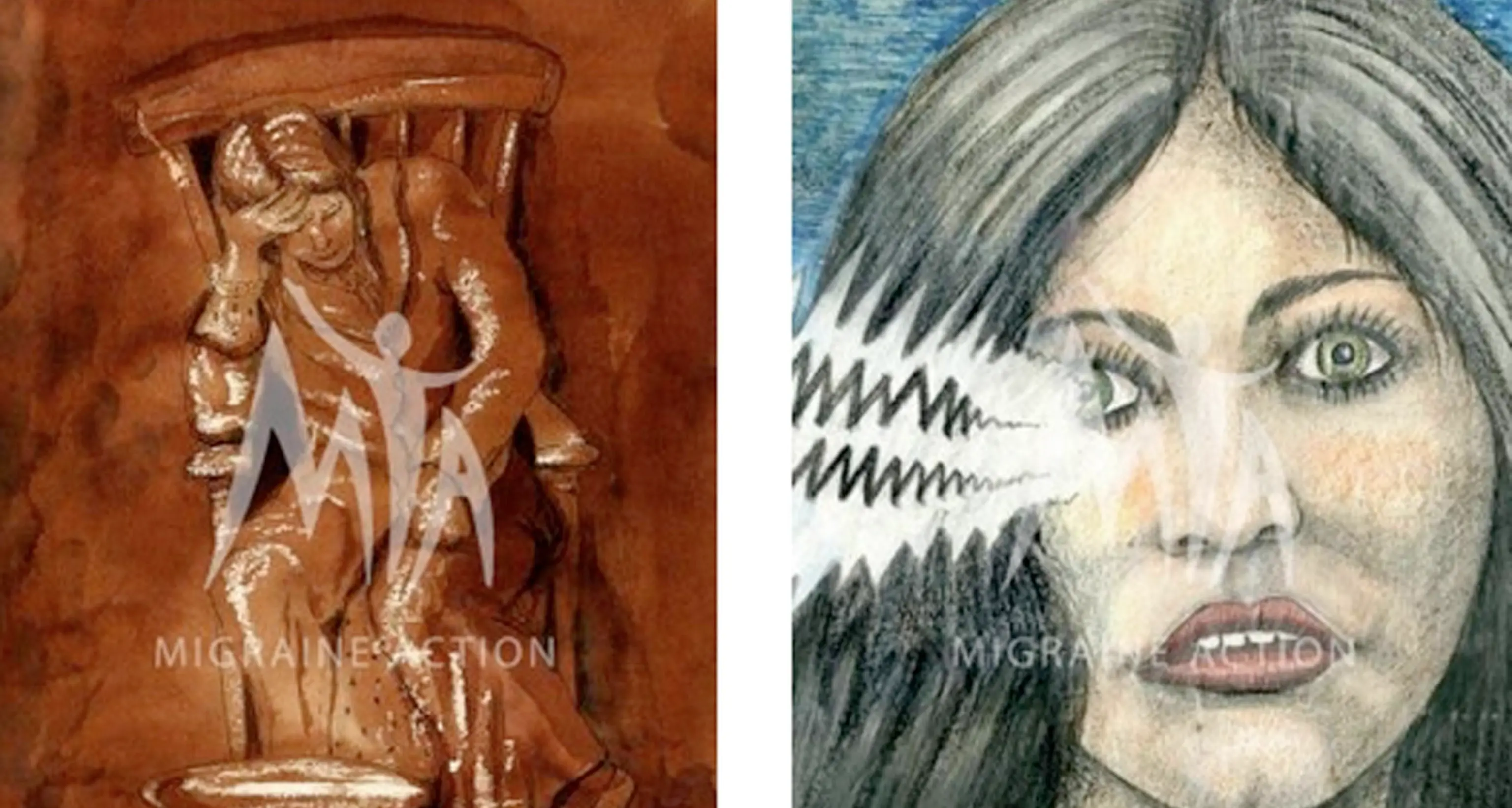 L'arte spiega l'emicrania in 500 opere organizzate in un sito dall'Università di Leicester